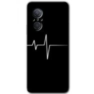 Huawei Nova 9 SE Heart Rytm Baskılı Uyumlu Silikon Kılıf
