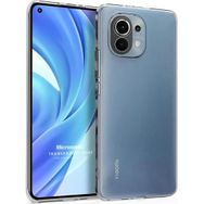 Microsonic Xiaomi Mi 11 Lite Transparent Soft Beyaz Kılıf