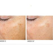Neostrata Enlighten Illuminating 30 ML Leke Giderici Serum