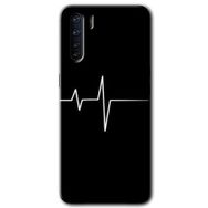 Oppo A91 Heart Rytm Baskılı Uyumlu Silikon Kılıf