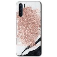 Oppo A91 Simli Mermer Baskılı Uyumlu Silikon Kılıf