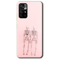 Poco M4 Pro 5G Yaşayan Çift Baskılı Uyumlu Silikon Kılıf