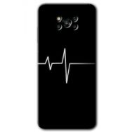 Poco X3 NFC Heart Rytm Baskılı Uyumlu Silikon Kılıf