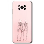 Poco X3 NFC Yaşayan Çift Baskılı Uyumlu Silikon Kılıf