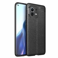 Teleplus Xiaomi Mi 11 Kılıf Lüks Kamera Korumalı Deri Dokulu Silikon Siyah Tam Kapatan Ekran Koruyucu