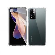 Teleplus Xiaomi Redmi Note 11 Pro Kılıf Darbe Korumalı Silikon Şeffaf Nano Ekran Koruyucu