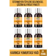 Valide Sultan 6x20 ml Tüy Azaltıcı Karınca Yumurtası Yağı