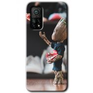 Xiaomi Mi 10 T Hd Desen Baskılı I am Groot Arka Kapak Kılıf