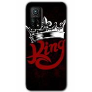 Xiaomi Mi 10 T Hd Desen Baskılı King Arka Kapak Kılıf