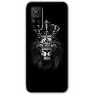 Xiaomi Mi 10 T Hd Desen Baskılı King Lion Arka Kapak Kılıf