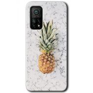 Xiaomi Mi 10 T Pro Hd Desen Baskılı Ananas Arka Kapak Kılıf