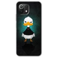 Xiaomi Mi 11 Angry Duck Baskılı Uyumlu Silikon Kılıf