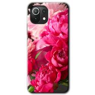 Xiaomi Mi 11 Kırmızı Beyaz Gül Baskılı Uyumlu Silikon Kılıf