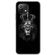 Xiaomi Mi 11 Lion King Baskılı Uyumlu Silikon Kılıf