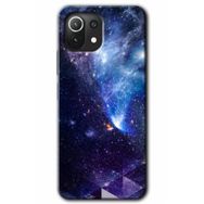 Xiaomi Mi 11 Lite Hd Desen Baskılı Galaksi Arka Kapak Kılıf