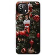 Xiaomi Mi 11 Lite Hd Desen Baskılı Happy New Year Arka Kapak Kılıf