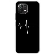 Xiaomi Mi 11 Lite Hd Desen Baskılı Heart Rytm Arka Kapak Kılıf