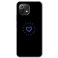 Xiaomi Mi 11 Lite Hd Desen Baskılı Heart Strokes Arka Kapak Kılıf