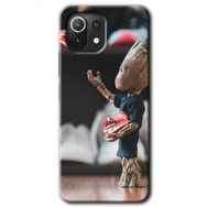Xiaomi Mi 11 Lite Hd Desen Baskılı I Am Groot Arka Kapak Kılıf