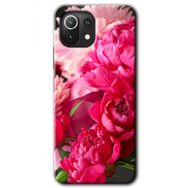 Xiaomi Mi 11 Lite Hd Desen Baskılı Kırmızı Beyaz Gül Arka Kapak Kılıf