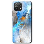 Xiaomi Mi 11 Lite Hd Desen Baskılı Mavi Buzul Arka Kapak Kılıf