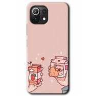Xiaomi Mi 11 Lite Hd Desen Baskılı Meyveli Süt Arka Kapak Kılıf