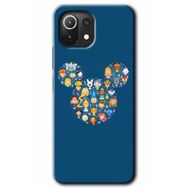 Xiaomi Mi 11 Lite Hd Desen Baskılı Mickey Arka Kapak Kılıf