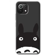Xiaomi Mi 11 Lite Hd Desen Baskılı Şaşkın Eşek Arka Kapak Kılıf