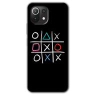 Xiaomi Mi 11 Lite Hd Desen Baskılı Sauce Arka Kapak Kılıf