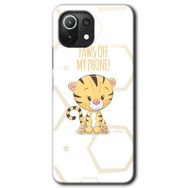 Xiaomi Mi 11 Lite Hd Desen Baskılı Sevimli Kedi 1 Arka Kapak Kılıf