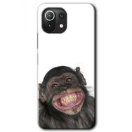 Xiaomi Mi 11 Lite Hd Desen Baskılı Şıpsevdi Aşk Arka Kapak Kılıf