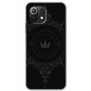 Xiaomi Mi 11 Lite Hd Desen Baskılı Siyah Mandala 1 Arka Kapak Kılıf