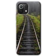 Xiaomi Mi 11 Lite Hd Desen Baskılı Tren Yolu Arka Kapak Kılıf