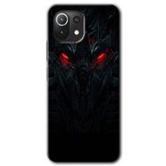 Xiaomi Mi 11 Lite Hd Desen Baskılı Vinicius Arka Kapak Kılıf