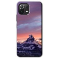 Xiaomi Mi 11 Lite Hd Desen Baskılı Zirve Arka Kapak Kılıf