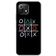 Xiaomi Mi 11 Sauce Baskılı Uyumlu Silikon Kılıf