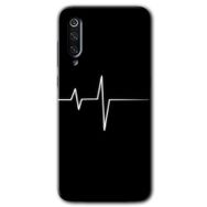Xiaomi Mi 9 SE Heart Rytm Baskılı Uyumlu Silikon Kılıf