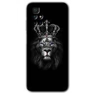 Xiaomi Redmi 10 King Lion Baskılı Uyumlu Silikon Kılıf