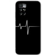 Xiaomi Redmi Note 11 4G Heart Rytm Baskılı Uyumlu Silikon Kılıf