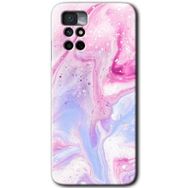 Xiaomi Redmi Note 11 4G Kabarmış Leke Baskılı Uyumlu Silikon Kılıf