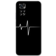 Xiaomi Redmi Note 11 5G Global Heart Rytm Baskılı Uyumlu Silikon Kılıf