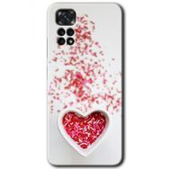 Xiaomi Redmi Note 11 5G Global Kalpli Şekerleme Baskılı Uyumlu Silikon Kılıf