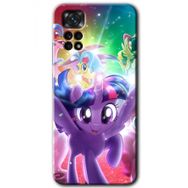 Xiaomi Redmi Note 11 5G Global Pony Baskılı Uyumlu Silikon Kılıf