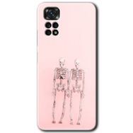 Xiaomi Redmi Note 11 5G Global Yaşayan Çift Baskılı Uyumlu Silikon Kılıf