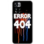 Xiaomi Redmi Note 11 Pro Plus 5G 404 Error Baskılı Uyumlu Silikon Kılıf