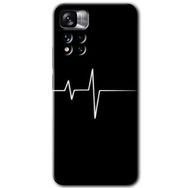 Xiaomi Redmi Note 11 Pro Plus 5G Heart Rytm Baskılı Uyumlu Silikon Kılıf