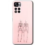 Xiaomi Redmi Note 11 Pro Plus 5G Yaşayan Çift Baskılı Uyumlu Silikon Kılıf