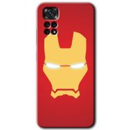 Xiaomi Redmi Note 11S 5G Global İronMan Baskılı Uyumlu Silikon Kılıf