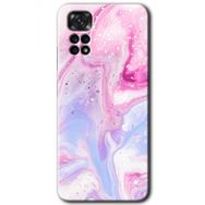 Xiaomi Redmi Note 11S 5G Global Kabarmış Leke Baskılı Uyumlu Silikon Kılıf