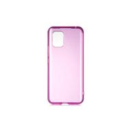 Zore Xiaomi Mi 10 Lite Bistro Kapak Kılıf
